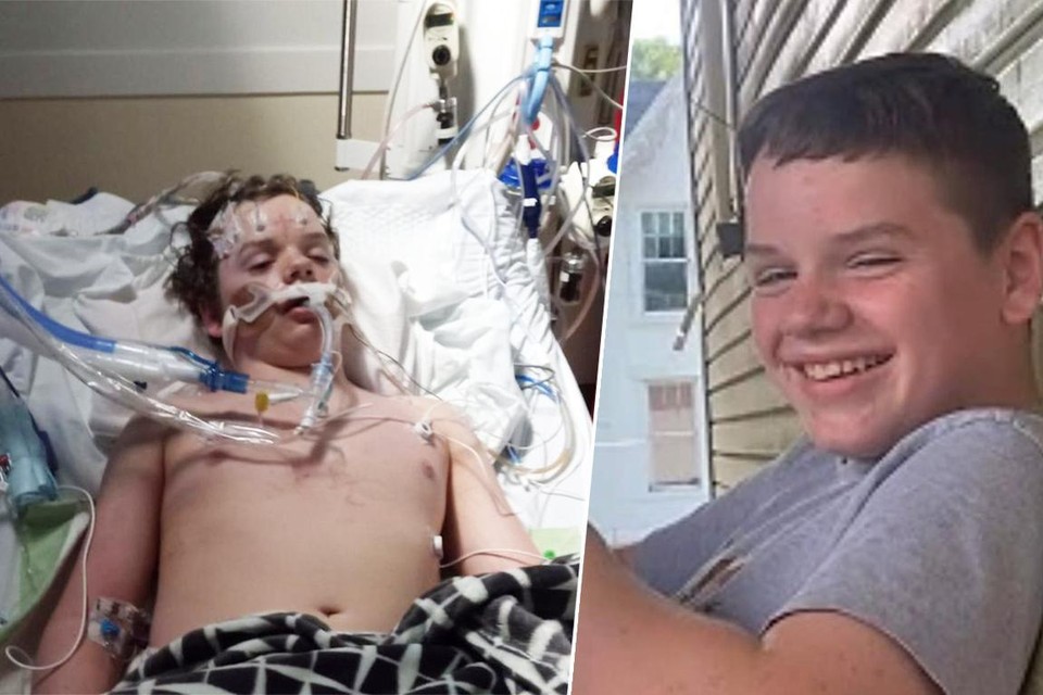 De ouders van Jacob Stevens verspreidden een foto van hun zoon in het ziekenhuis om de gevaren van de TikTok-challenge zichtbaar te maken.