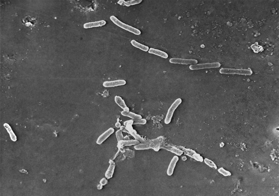De ‘pseudomonas aeruginosa’-bacterie.