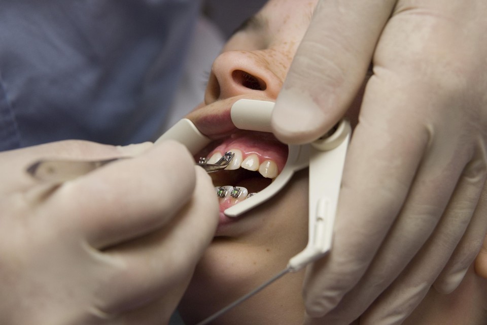 Schaarste aan orthodontisten zorgt voor lange wachttijden en patiëntenstops