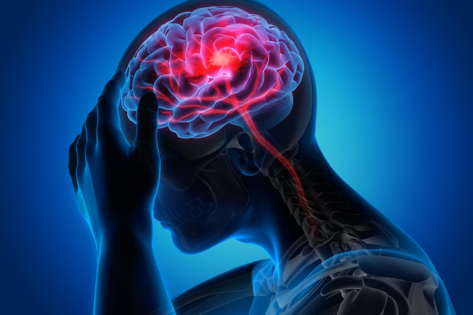 Als na drie maanden blijkt dat bij een patiënt het aantal migrainedagen niet gehalveerd is, stopt de terugbetaling. 