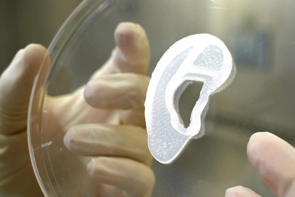 3D bio-implantaat 