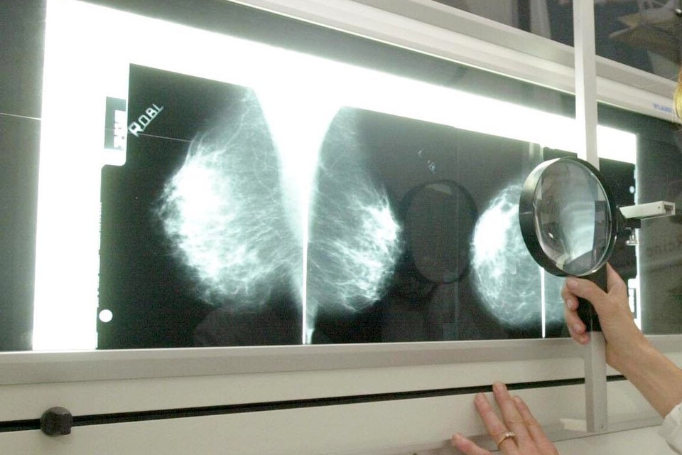 Bij borst-, prostaat- en darmkanker werd veel vooruitgang geboekt. 