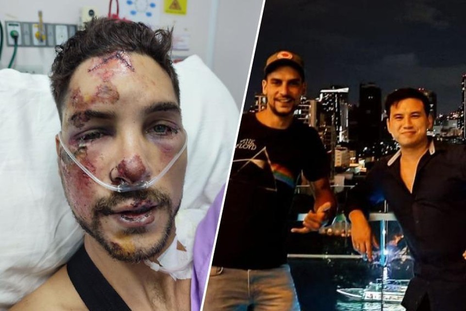 Links: Tom houdt ernstige verwondingen over aan een aanrijding eerder deze week. Rechts: Tom en zijn overleden boezemvriend Nicolaas in Bangkok, een dag voor de aanrijding van Tom.  